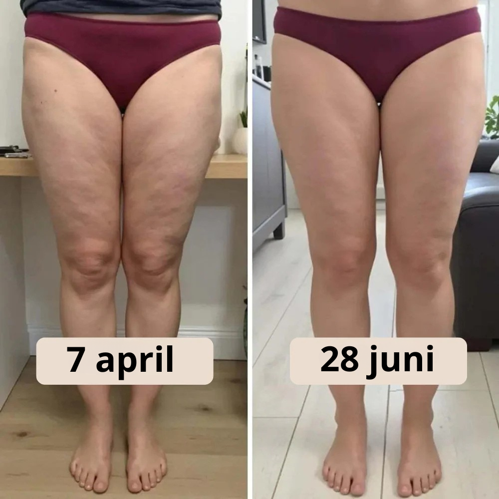 Winksy PowerLeggings™ | 3D Metabolisme Booster