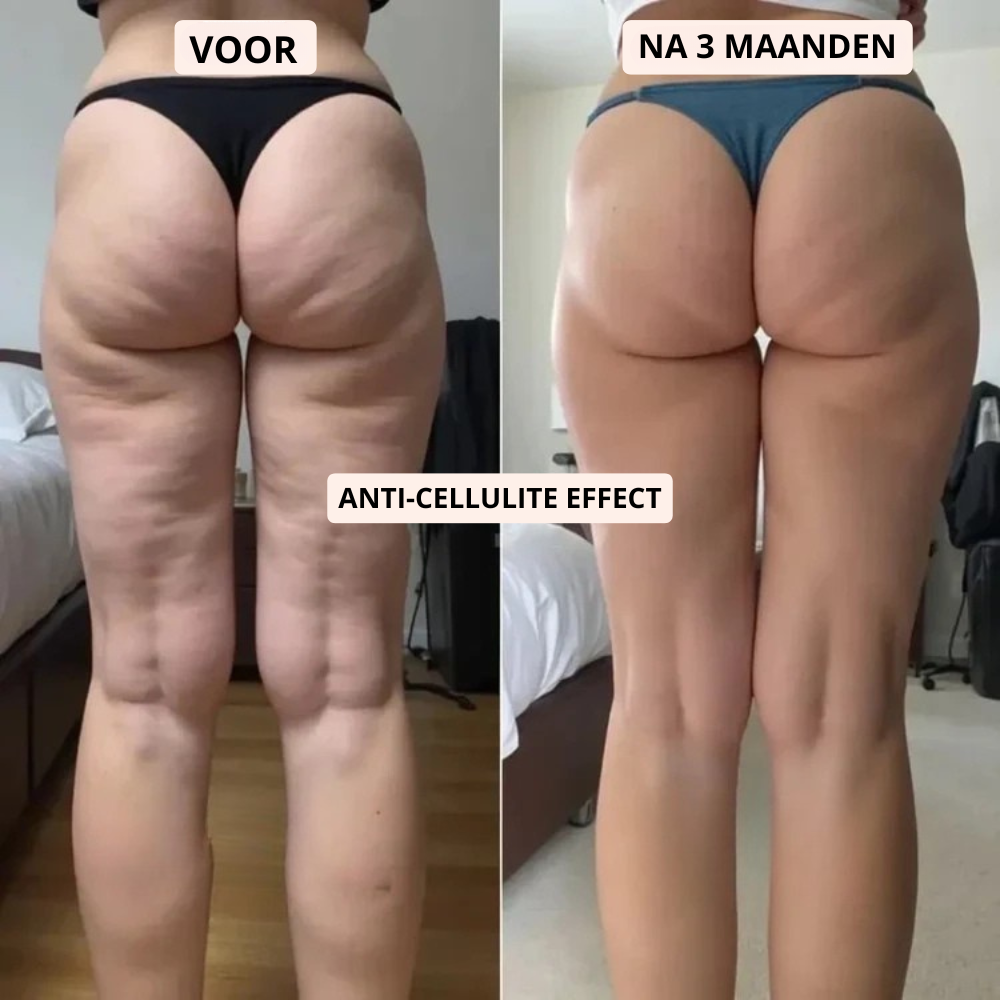 Winksy PowerLeggings™ | 3D Metabolisme Booster